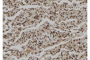 ABIN6273210 at 1/100 staining Human lung tissue by IHC-P. (CNOT10 Antikörper  (Internal Region))