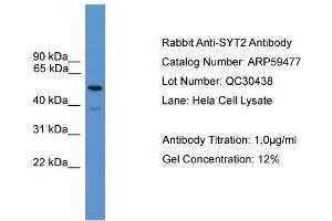 WB Suggested Anti-SYT2  Antibody Titration: 0.