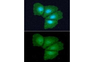 ICC/IF analysis of ADI1 in Hep3B cells line, stained with DAPI (Blue) for nucleus staining and monoclonal anti-human ADI1 antibody (1:100) with goat anti-mouse IgG-Alexa fluor 488 conjugate (Green). (ADI1 Antikörper)