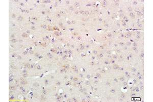 Formalin-fixed and paraffin embedded rat brain labeled with Anti-FGFR3/CD333 Polyclonal Antibody, Unconjugated (ABIN674664) at 1:200 followed by conjugation to the secondary antibody and DAB staining (FGFR3 Antikörper  (AA 501-600))