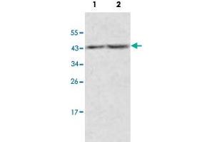 Western blot analysis of human fetal kidney (Lane 1) and fetal thymus (Lane 2) lysate with ACOT9 polyclonal antibody  at 1 : 500 dilution.