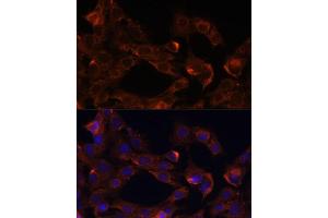 Immunofluorescence analysis of C6 cells using Neuropilin-1 (Neuropilin-1 (NRP1)) antibody (ABIN7268892) at dilution of 1:100.