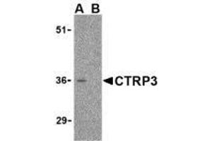 Western blot analysis of CTRP3 in mouse heart cell lysate with AP30251PU-N CTRP3 antibody at 1 μg/ml in the (A) absence and (B) presence of blocking peptide. (C1QTNF3 Antikörper  (Intermediate Domain))