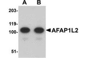 Western Blotting (WB) image for anti-Actin Filament Associated Protein 1-Like 2 (AFAP1L2) (C-Term) antibody (ABIN1030225) (AFAP1L2 Antikörper  (C-Term))
