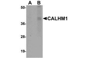 Western blot analysis of CALHM1 in rat liver tissue lysate with AP30176PU-N CALHM1 antibody at (A) 1 and (B) 2 μg/ml.