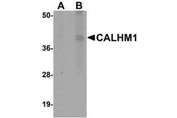 CALHM1 抗体  (N-Term)