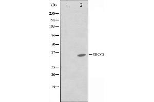 Western blot analysis on NIH-3T3 cell lysate using ERCC1 Antibody,The lane on the left is treated with the antigen-specific peptide. (ERCC1 Antikörper  (Internal Region))