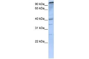 WB Suggested Anti-PCAF Antibody Titration: 0. (KAT2B Antikörper  (C-Term))