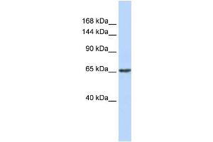 WB Suggested Anti-ZNF91 Antibody Titration:  0. (ZFP91 Antikörper  (N-Term))