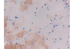 Immunohistochemistry (IHC) image for anti-Colony Stimulating Factor 1 (Macrophage) (CSF1) (AA 33-204) antibody (ABIN7430927)