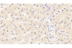 Immunohistochemistry (IHC) image for anti-Matrix Metallopeptidase 3 (Stromelysin 1, Progelatinase) (MMP3) (AA 18-477) antibody (ABIN7431005)