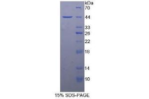 SDS-PAGE analysis of Rat Nephrin Protein.
