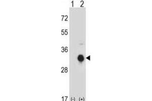 Western Blotting (WB) image for anti-Kallikrein 10 (KLK10) antibody (ABIN2998072) (Kallikrein 10 Antikörper)
