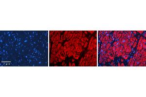 Rabbit Anti-CBR1 Antibody   Formalin Fixed Paraffin Embedded Tissue: Human heart Tissue Observed Staining: Cytoplasmic Primary Antibody Concentration: N/A Other Working Concentrations: 1:600 Secondary Antibody: Donkey anti-Rabbit-Cy3 Secondary Antibody Concentration: 1:200 Magnification: 20X Exposure Time: 0. (CBR1 Antikörper  (Middle Region))