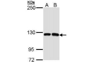 WB Image Sample (30 ug of whole cell lysate) A: Molt-4 , B: Raji 5% SDS PAGE antibody diluted at 1:1000 (MCF2L Antikörper  (N-Term))