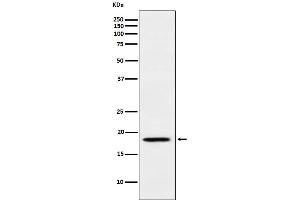 Western Blotting (WB) image for anti-Nudix (Nucleoside Diphosphate Linked Moiety X)-Type Motif 1 (NUDT1) antibody (ABIN7607040)