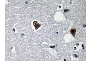 Immunohistochemistry analyzes of Sarcoglycan-β antibody in paraffin-embedded human brain tissue. (SGCB Antikörper)