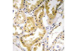Immunohistochemical analysis of ABHD4 staining in human kidney formalin fixed paraffin embedded tissue section.