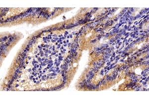 Detection of C1QBP in Mouse Small intestine Tissue using Polyclonal Antibody to Complement component 1 Q subcomponent-binding protein, mitochondrial (C1QBP) (C1QBP Antikörper  (AA 71-278))