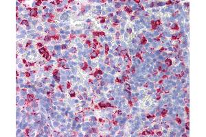 Anti-CD68 antibody IHC of rat spleen. (CD68 Antikörper)