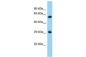 WB Suggested Anti-Zbtb7a Antibody   Titration: 1. (ZBTB7A Antikörper  (C-Term))