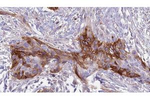 Immunohistochemistry (IHC) image for anti-UDP-Gal:betaGlcNAc beta 1,4 Galactosyltransferase, Polypeptide 1 (B4GALT1) (C-Term) antibody (ABIN6259493)