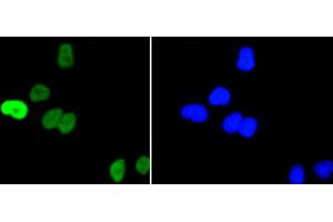 HeLa cells were stained with c-Myc(S62) (1A7 ) Monoclonal Antibody (b at [1:200] incubated overnight at 4C, followed by secondary antibody incubation, DAPI staining of the nuclei and detection. (c-MYC Antikörper  (pSer62))