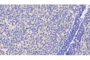 Immunohistochemistry (IHC) image for anti-BH3 Interacting Domain Death Agonist (BID) (AA 1-195) antibody (ABIN7432259)