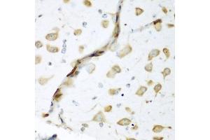 Immunohistochemistry (IHC) image for anti-ELAV (Embryonic Lethal, Abnormal Vision, Drosophila)-Like 2 (Hu Antigen B) (ELAVL2) (AA 1-100) antibody (ABIN6140114)