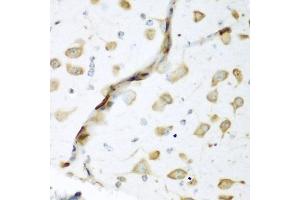 Immunohistochemistry of paraffin-embedded mouse brain using EL antibody (ABIN6134649, ABIN6140114, ABIN6140116 and ABIN6221621) at dilution of 1:200 (40x lens). (ELAVL2 Antikörper  (AA 1-100))