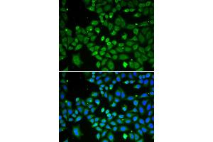 Immunofluorescence analysis of A549 cell using ECI1 antibody. (DCI Antikörper  (AA 63-302))