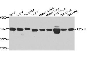 Western blot analysis of extracts of various cell lines, using P2RY14 antibody. (P2RY14 Antikörper  (AA 209-338))