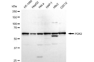 Western blotting analysis using PCK2 antibody (ABIN7799800).