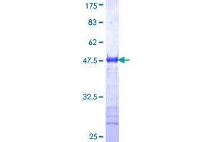 Image no. 1 for Golgi Membrane Protein 1 (GOLM1) (AA 302-401) protein (GST tag) (ABIN1355471)