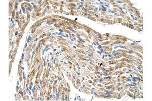 FADS1 antibody was used for immunohistochemistry at a concentration of 4-8 ug/ml to stain Skeletal muscle cells (arrows) in Human Muscle. (FADS1 Antikörper  (C-Term))