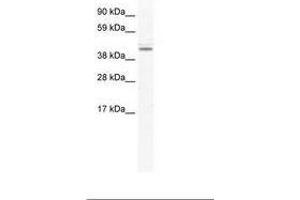DDX49 Antikörper  (AA 81-130)