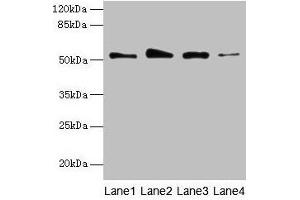 Western blot All lanes: GSDMD antibody at 4 μg/mL Lane 1: Jurkat whole cell lysate Lane 2: Hela whole cell lysate Lane 3: A431 whole cell lysate Lane 4: U251 whole cell lysate Secondary Goat polyclonal to rabbit IgG at 1/10000 dilution Predicted band size: 53 kDa Observed band size: 53 kDa