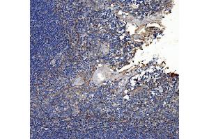 IHC analysis of Collagen VII/COL7A1 using anti-Collagen VII/COL7A1 antibody (ABIN7601052).