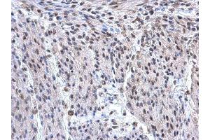 IHC-P Image hnRNP F antibody [N1N3] detects hnRNP F protein at nucleus on mouse uterus by immunohistochemical analysis. (HNRNPF Antikörper)