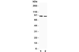 Western blot testing of SLC9A2 antibody and Lane 1:  rat skeletal musle;  2: rat kidney tissue lysate. (SLC9A2 Antikörper  (C-Term))