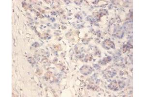 Immunohistochemistry of paraffin-embedded human pancreatic tissue using ABIN7157084 at dilution of 1:100 (Amylin/DAP Antikörper  (AA 34-70))