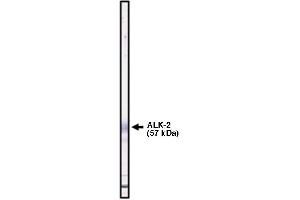 Western blot using ALK-2 antibody   on ALK-2 fusion  protein. (ACVR1 Antikörper  (Extracellular Domain))