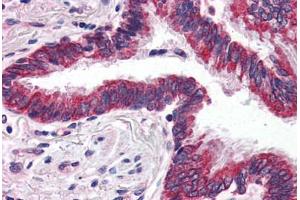 Human Lung (formalin-fixed, paraffin-embedded) stained with GRIK1 antibody ABIN343897 at 5 ug/ml followed by biotinylated goat anti-rabbit IgG secondary antibody ABIN481713, alkaline phosphatase-streptavidin and chromogen. (GRIK1 Antikörper  (C-Term))