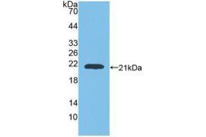Western blot analysis of recombinant Rat GaA. (GAA Antikörper  (AA 70-225))