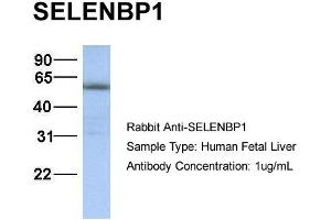 WB Suggested Anti-SELENBP1 antibody Titration: 1 ug/mL Sample Type: Human liver
