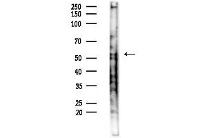 anti-Drebrin-Like (DBNL) (C-Term) antibody
