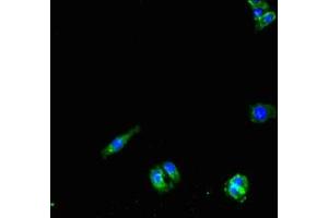Immunofluorescent analysis of HepG2 cells using ABIN7162688 at dilution of 1:100 and Alexa Fluor 488-congugated AffiniPure Goat Anti-Rabbit IgG(H+L) (PNPLA1 Antikörper  (AA 101-300))