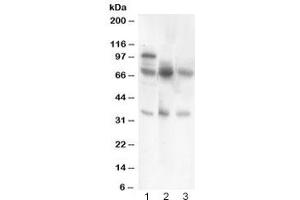 Western blot testing of GAD67 antibody and Lane 1:  rat brain (GAD Antikörper  (AA 14-122))