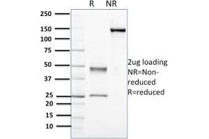 Purified Nucleophosmin-Monospecific Mouse Monoclonal Antibody (NPM1/3398). (NPM1 Antikörper  (AA 185-287))