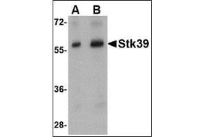 Western blot analysis of Stk39 in rat brain tissue lysate with this product at (A) 1 and (B) 2 μg/ml. (STK39 Antikörper  (Center))